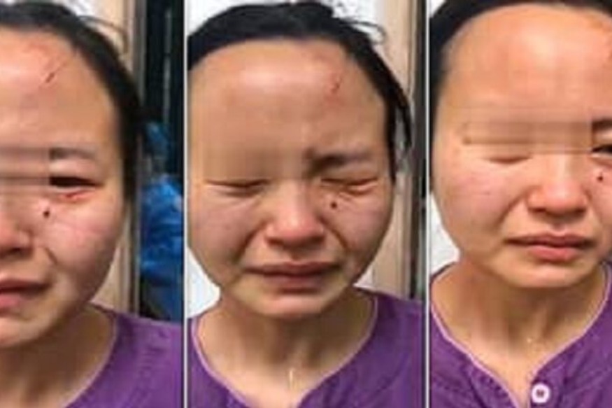 CHINE :  un africain atteint du coronavirus mord sauvagement le nez d’une infirmière chinoise